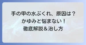 手の甲の汗疱の原因と治し方を徹底解説！かゆみと水ぶくれを乗り越える方法