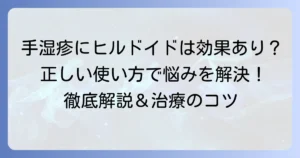 手湿疹にヒルドイドは効果的？正しい使い方と治療のコツを徹底解説