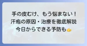 手の皮がむける汗疱の悩みを解決！原因から治療、予防まで徹底解説