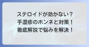 手湿疹にステロイドが効かない原因と効果的な対策を徹底解説